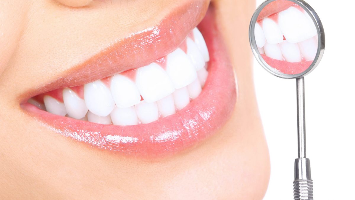 Teeth Whitening at Dentist Wasilla